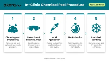 5-step chemical peel in-clinic procedure process flow diagram