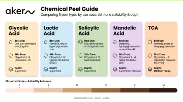 Five chemical peel types comparison chart for tan removal and skin suitability