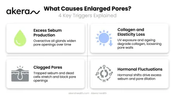 Four main causes of enlarged pores illustrated in skincare infographic