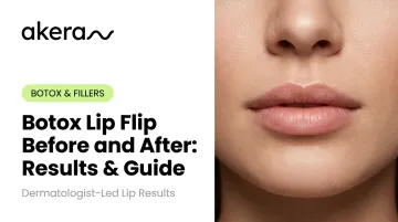 Botox Lip Flip Before and After: Results &amp; Guide