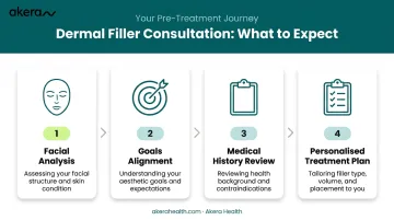 Four-step dermal filler consultation process infographic from facial analysis to treatment plan