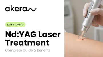 Nd:YAG Laser Treatment: Complete Guide &amp; Benefits