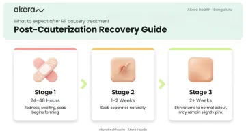 Wart cauterization recovery timeline showing healing stages over two weeks