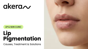 Lip Pigmentation: Causes, Treatment &amp; Solutions