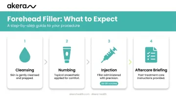 Four-step forehead filler procedure process flow from cleansing to aftercare