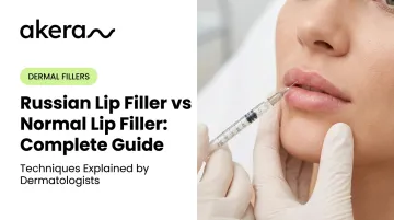 Russian Lip Filler vs Normal Lip Filler: Complete Guide
