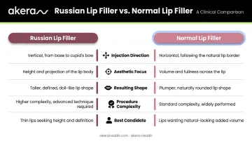 Russian lip filler versus normal lip filler five-feature side-by-side comparison chart