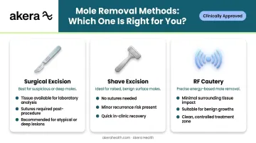 Three facial mole removal methods surgical shave excision and RF cautery comparison