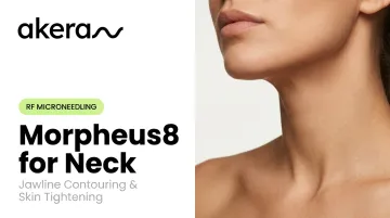 Morpheus8 for Neck: Jawline Contouring &amp; Skin Tightening