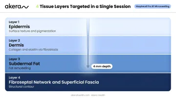 Morpheus8 four-layer tissue targeting depth diagram from epidermis to fascia