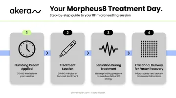 Morpheus8 neck treatment four-step on-the-day process flow infographic