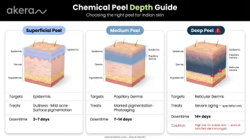 Three chemical peel depth levels comparison superficial medium and deep skin layers