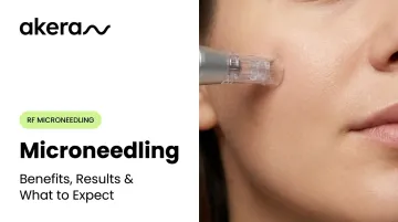 Microneedling: Benefits, Results &amp; What to Expect