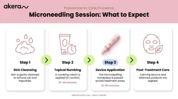 4-step professional microneedling procedure sequence from cleansing to post-treatment care