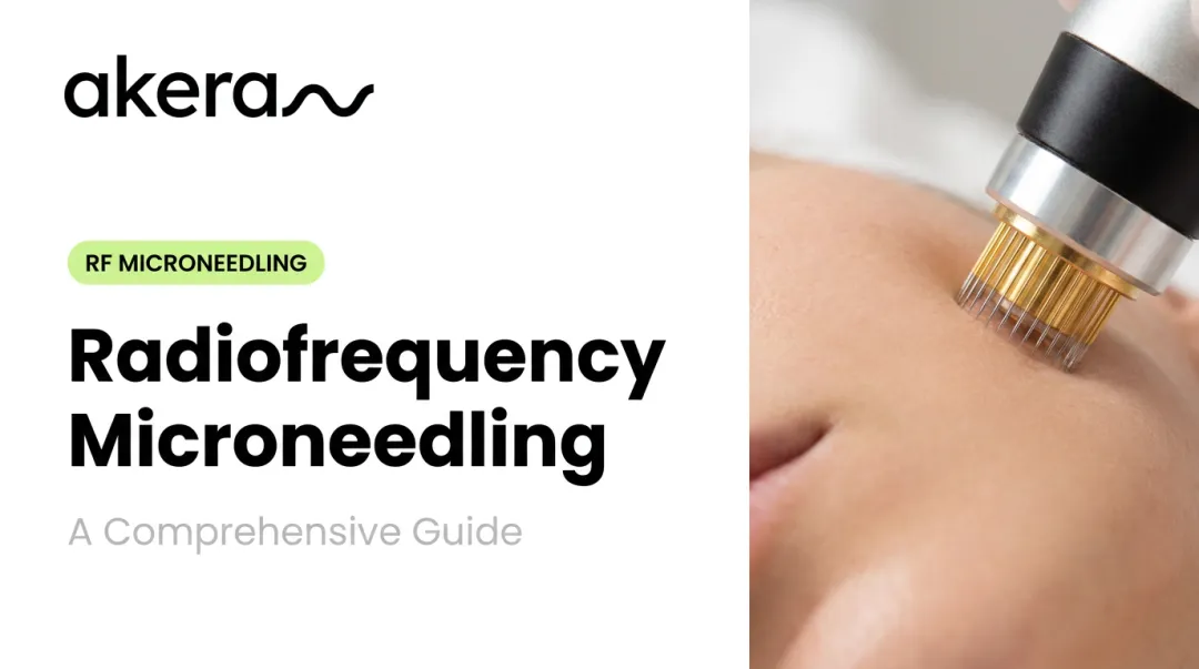 Radiofrequency Microneedling: A Comprehensive Guide