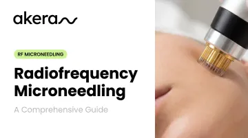 Radiofrequency Microneedling: A Comprehensive Guide