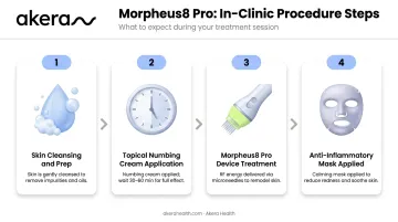 4-step RF microneedling in-clinic procedure from skin cleansing to post-treatment mask application