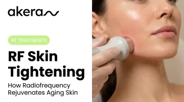 RF Skin Tightening: How Radiofrequency Rejuvenates Aging Skin