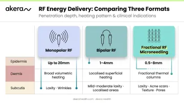 Three RF skin tightening delivery formats comparison chart monopolar bipolar fractional microneedling