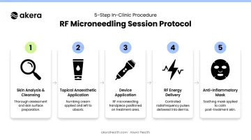 5-step RF microneedling treatment session protocol process flow infographic