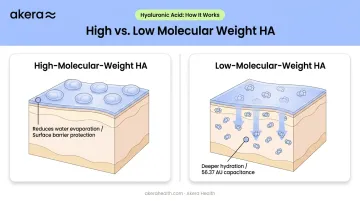 High versus low molecular weight hyaluronic acid skin penetration comparison infographic