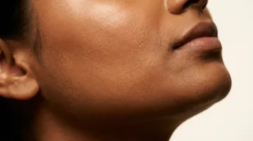 Close-up of healthy plump glowing skin showing elasticity and hydration results