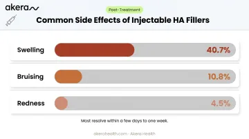 Injectable hyaluronic acid filler common side effects frequency percentage breakdown chart