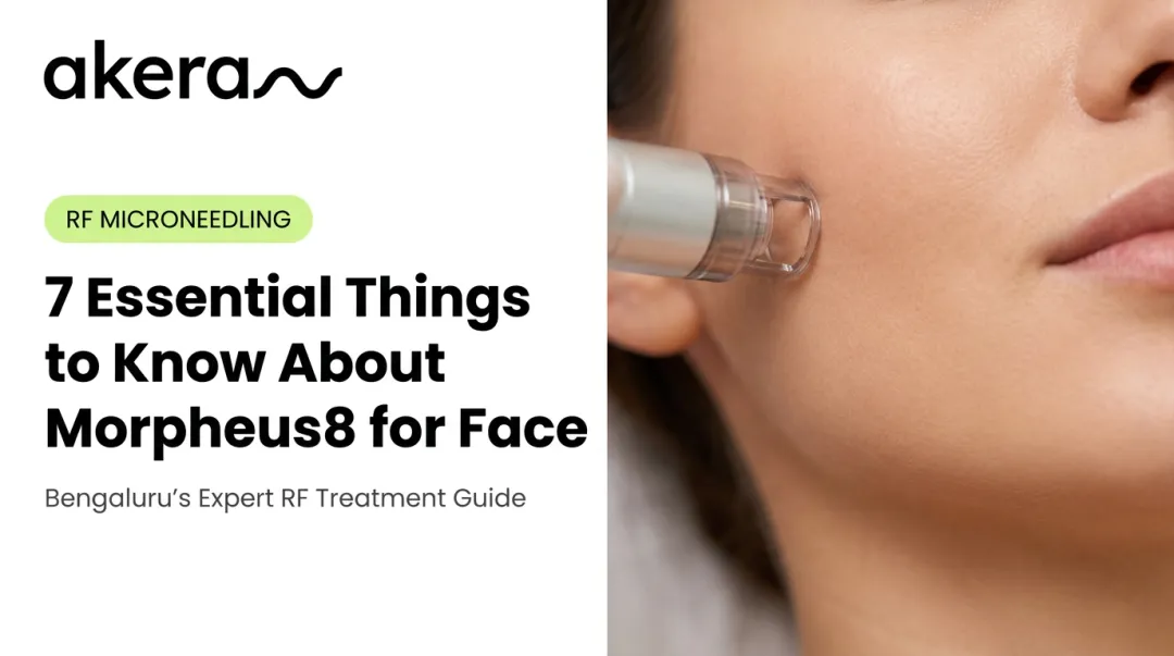 7 Essential Things to Know About Morpheus8 for Face