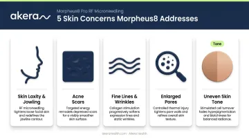 Morpheus8 skin concerns treated including laxity acne scars and enlarged pores