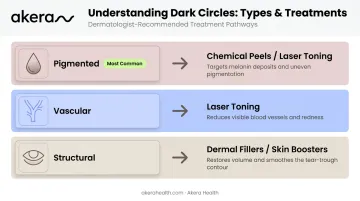 Dark circle treatment types matched to pigmented vascular and structural causes infographic