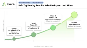 Non-surgical skin tightening results timeline from treatment day to twelve months