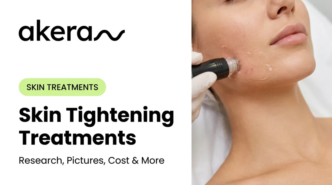 Skin Tightening Treatments: Research, Pictures, Cost & More
