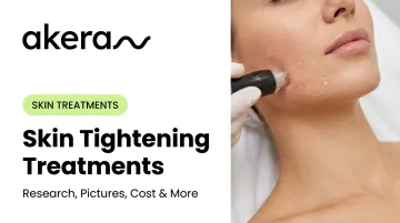 Skin Tightening Treatments: Research, Pictures, Cost &amp; More