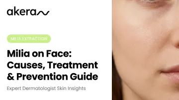 Milia on Face: Causes, Treatment &amp; Prevention Guide