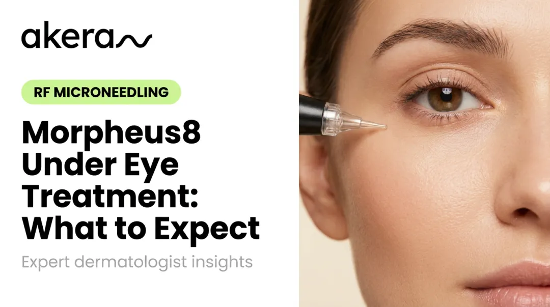 Morpheus8 Under Eye Treatment: What to Expect