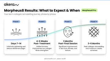 Morpheus8 under-eye results timeline four-phase collagen remodelling progression chart