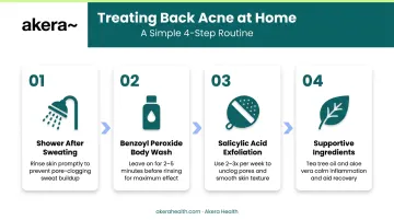 4-step back acne home skincare routine process flow infographic