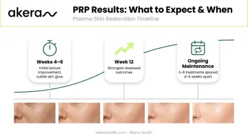 PRP treatment results timeline from four weeks to twelve weeks and beyond
