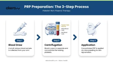 Three-step PRP preparation process blood draw centrifugation and application