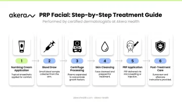 Six-step PRP facial procedure sequence from numbing cream to post-treatment care