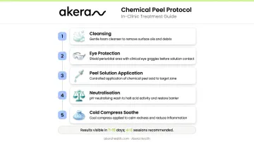 Five-step dermatologist chemical peel protocol infographic for tan removal