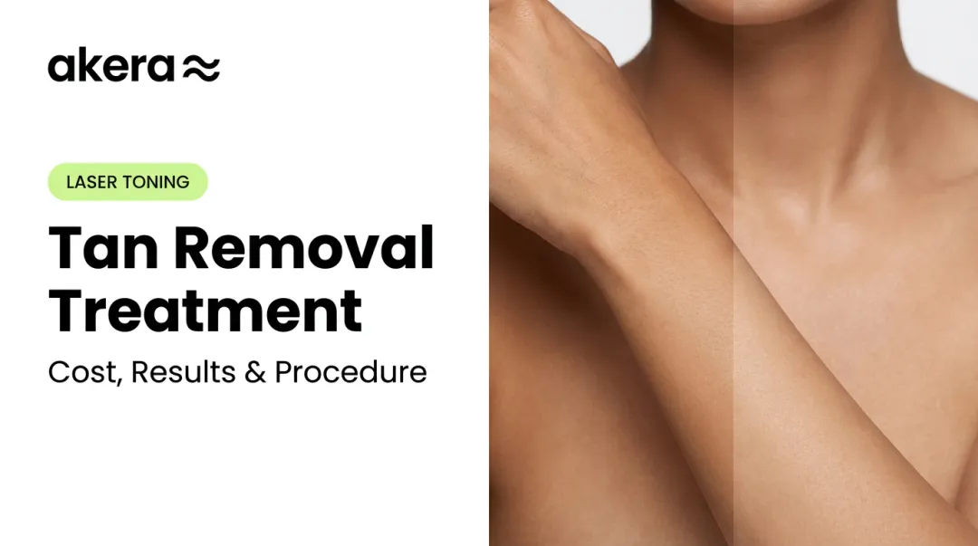 Tan Removal Treatment: Cost, Results & Procedure