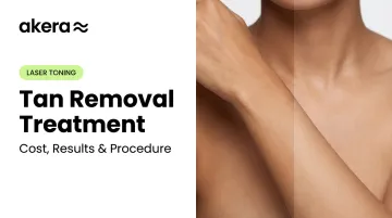 Tan Removal Treatment: Cost, Results & Procedure