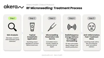 5-step Morpheus8 RF microneedling protocol process flow diagram
