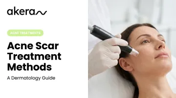 Acne Scar Treatment Methods: A Dermatology Guide