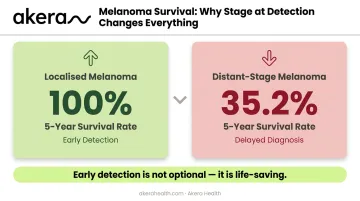 Melanoma survival rate comparison localised versus distant stage five-year outcomes