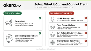 Botox under-eye treatment comparison chart effective versus ineffective concerns