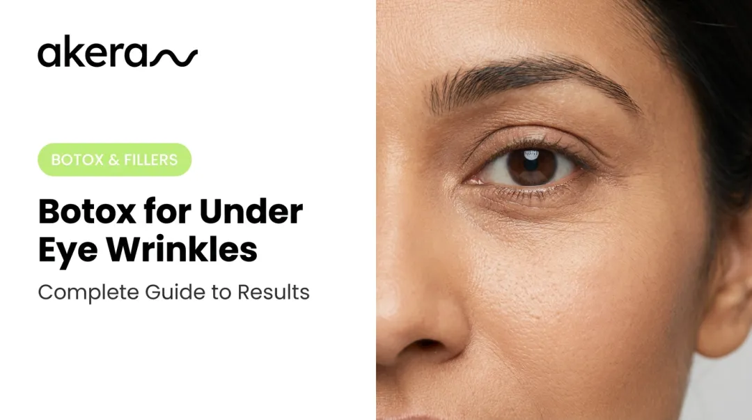 Botox for Under Eye Wrinkles: Complete Guide to Results