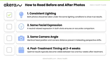 4-point checklist for evaluating cheek filler before and after photos accurately