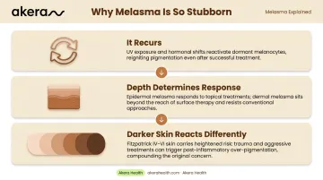 Three key reasons melasma is difficult to treat infographic